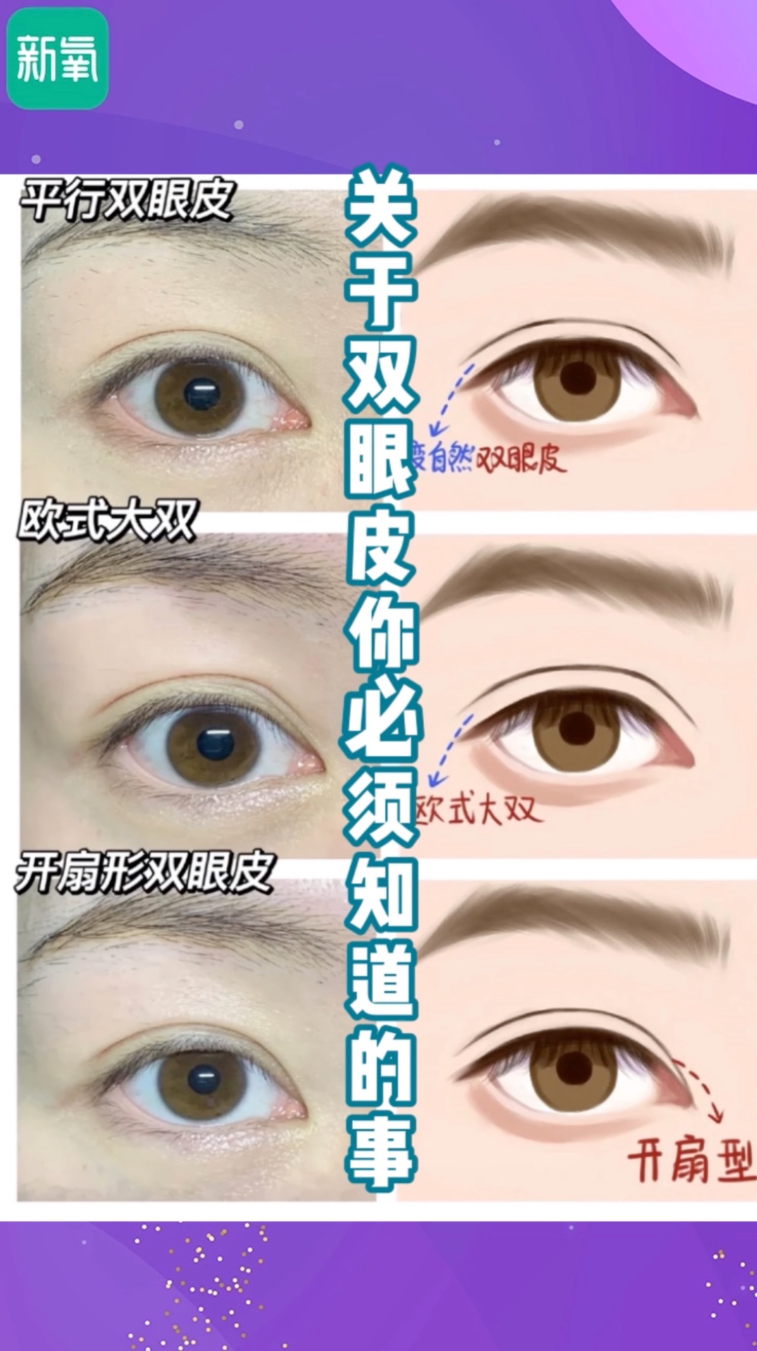 新氧